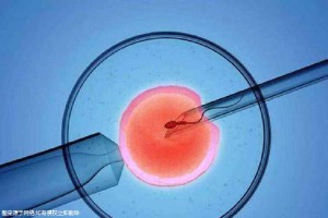 张蓝之主任